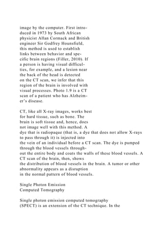 image by the computer. First intro-
duced in 1973 by South African
physicist Allan Cormack and British
engineer Sir Godfrey Hounsfield,
this method is used to establish
links between behavior and spe-
cific brain regions (Filler, 2010). If
a person is having visual difficul-
ties, for example, and a lesion near
the back of the head is detected
on the CT scan, we infer that this
region of the brain is involved with
visual processes. Photo 1.9 is a CT
scan of a patient who has Alzheim-
er’s disease.
CT, like all X-ray images, works best
for hard tissue, such as bone. The
brain is soft tissue and, hence, does
not image well with this method. A
dye that is radiopaque (that is, a dye that does not allow X-rays
to pass through it) is injected into
the vein of an individual before a CT scan. The dye is pumped
through the blood vessels through-
out the entire body and coats the walls of these blood vessels. A
CT scan of the brain, then, shows
the distribution of blood vessels in the brain. A tumor or other
abnormality appears as a disruption
in the normal pattern of blood vessels.
Single Photon Emission
Computed Tomography
Single photon emission computed tomography
(SPECT) is an extension of the CT technique. In the
 