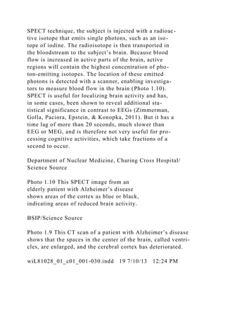 SPECT technique, the subject is injected with a radioac-
tive isotope that emits single photons, such as an iso-
tope of iodine. The radioisotope is then transported in
the bloodstream to the subject’s brain. Because blood
flow is increased in active parts of the brain, active
regions will contain the highest concentration of pho-
ton-emitting isotopes. The location of these emitted
photons is detected with a scanner, enabling investiga-
tors to measure blood flow in the brain (Photo 1.10).
SPECT is useful for localizing brain activity and has,
in some cases, been shown to reveal additional sta-
tistical significance in contrast to EEGs (Zimmerman,
Golla, Paciora, Epstein, & Konopka, 2011). But it has a
time lag of more than 20 seconds, much slower than
EEG or MEG, and is therefore not very useful for pro-
cessing cognitive activities, which take fractions of a
second to occur.
Department of Nuclear Medicine, Charing Cross Hospital/
Science Source
Photo 1.10 This SPECT image from an
elderly patient with Alzheimer’s disease
shows areas of the cortex as blue or black,
indicating areas of reduced brain activity.
BSIP/Science Source
Photo 1.9 This CT scan of a patient with Alzheimer’s disease
shows that the spaces in the center of the brain, called ventri-
cles, are enlarged, and the cerebral cortex has deteriorated.
wiL81028_01_c01_001-030.indd 19 7/10/13 12:24 PM
 