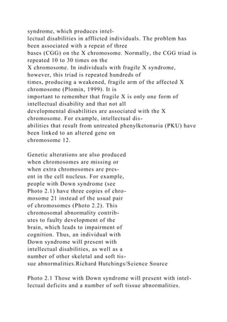 syndrome, which produces intel-
lectual disabilities in afflicted individuals. The problem has
been associated with a repeat of three
bases (CGG) on the X chromosome. Normally, the CGG triad is
repeated 10 to 30 times on the
X chromosome. In individuals with fragile X syndrome,
however, this triad is repeated hundreds of
times, producing a weakened, fragile arm of the affected X
chromosome (Plomin, 1999). It is
important to remember that fragile X is only one form of
intellectual disability and that not all
developmental disabilities are associated with the X
chromosome. For example, intellectual dis-
abilities that result from untreated phenylketonuria (PKU) have
been linked to an altered gene on
chromosome 12.
Genetic alterations are also produced
when chromosomes are missing or
when extra chromosomes are pres-
ent in the cell nucleus. For example,
people with Down syndrome (see
Photo 2.1) have three copies of chro-
mosome 21 instead of the usual pair
of chromosomes (Photo 2.2). This
chromosomal abnormality contrib-
utes to faulty development of the
brain, which leads to impairment of
cognition. Thus, an individual with
Down syndrome will present with
intellectual disabilities, as well as a
number of other skeletal and soft tis-
sue abnormalities.Richard Hutchings/Science Source
Photo 2.1 Those with Down syndrome will present with intel-
lectual deficits and a number of soft tissue abnormalities.
 