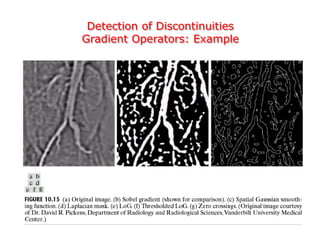 Detection of Discontinuities
Gradient Operators: Example
 