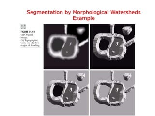 Segmentation by Morphological Watersheds
Example
 