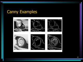 41
Canny Examples
 