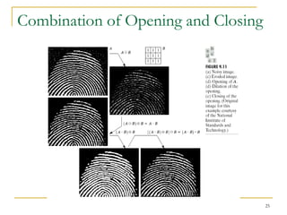 Combination of Opening and Closing




                                     25
 