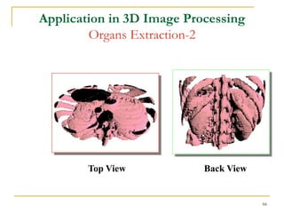 Application in 3D Image Processing
        Organs Extraction-2




        Top View           Back View


                                       66
 