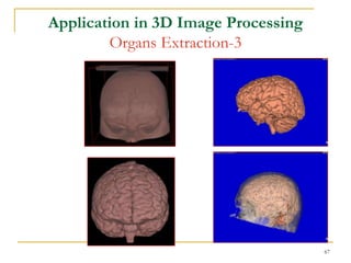 Application in 3D Image Processing
        Organs Extraction-3




                                     67
 