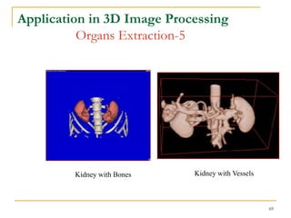 Application in 3D Image Processing
          Organs Extraction-5




         Kidney with Bones   Kidney with Vessels



                                                   69
 