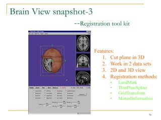 Brain View snapshot-3
                --Registration tool kit

                           Features:
                              1. Cut plane in 3D
                              2. Work in 2 data sets
                              3. 2D and 3D view
                              4. Registration methods:
                                 •   LandMark
                                 •   ThinPlateSpline
                                 •   GridTransform
                                 •   MutualInformation


                                                    70
 