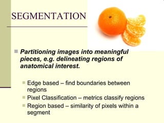 SEGMENTATION
 Partitioning images into meaningful
pieces, e.g. delineating regions of
anatomical interest.
 Edge based – find boundaries between
regions
 Pixel Classification – metrics classify regions
 Region based – similarity of pixels within a
segment
 