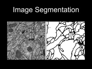 Image Segmentation
 