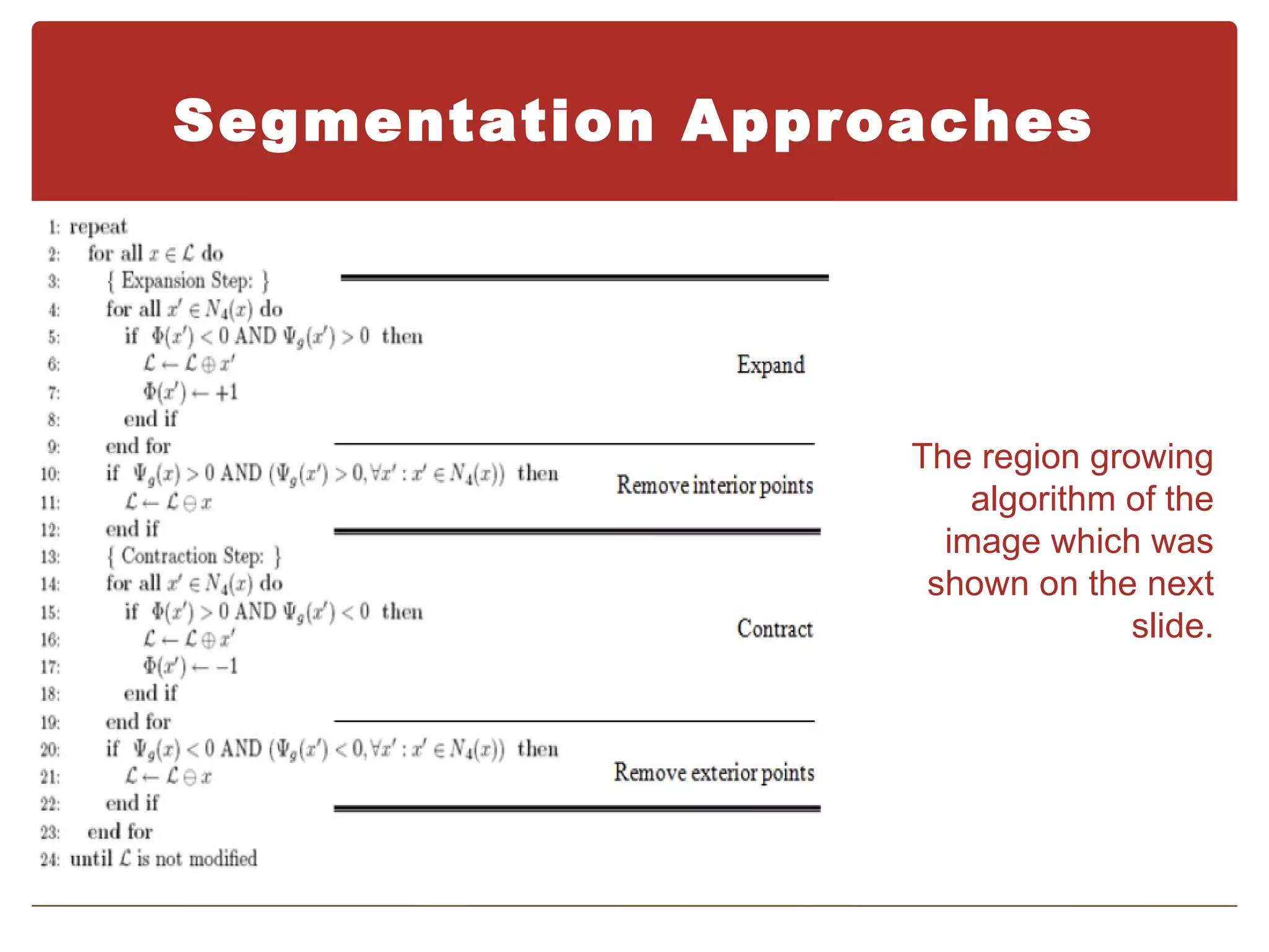 Segmentation Approaches




                  The region growing
                      algorithm of the
                    image which was
                   shown on the next
                                slide.
 