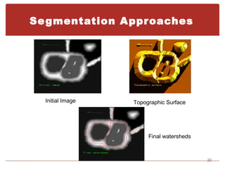 Se gmentation A ppr oaches




  Initial Image   Topographic Surface




                       Final watersheds



                                          22
 