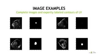 NVIDIA 深度學習教育機構 (DLI): Image segmentation with tensorflow | PDF