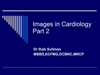 Images in Cardiology Part 2 Dr Ihab Suliman  MBBS,ECFMG,DCBNC,MRCP 