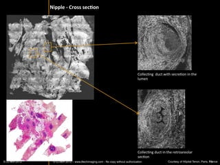 BRAIN	
  AND	
  SPINAL	
  CORD	
  




© LLTECH 2011                                        15
 