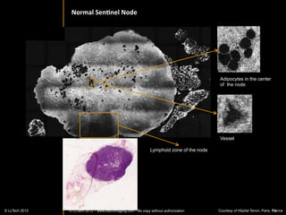 RAT	
  BRAIN	
  :	
  Diﬀerent	
  zoom	
  levels	
  


16x13mm2	
  




                            4x4mm2	
  
                            	
  




                                                                        1x1mm2	
  
                                                                        	
  




                               Advanced	
  	
  Imaging	
  in	
  	
  Bio	
  
          © LLTECH 2011                                                              19
 