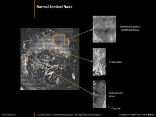 Spinal	
  cord	
  :	
  normal	
  Issue	
  




                                                                                        100 µm



                                                             Arrows: Fibers transverse cut




                                    500 µm




                                                                                     100 µm




© LLTECH 2011                                                                                    20
 