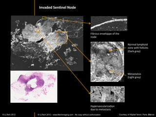 DERMATOLOGY	
  AND	
  COSMETICS	
  




© LLTECH 2011                                         21
 