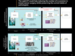 Skin	
  verIcal	
  reconstrucIon	
  from	
  en-­‐face	
  slicing	
  for	
  layers	
  
                                                assesment	
  and	
  measurement	
  
             KN:	
  KeraInocyte	
  nuclei	
  
                                                                                                   Papillary	
  melanin	
  caps	
  
            BV:	
  Blood	
  vessels	
  
                                                                                                                                                                        Stratum	
  corneum	
  
                                                                                                         KN	
                                    KN	
  
                                           KN	
  
                                                                                                                                                                        Stratum	
  spinosum	
  
                                                                             BV	
         BV	
  

                                                                                      BV	
                                                                               Dermis	
  
                                                                                                                                                   50	
  µm	
  




                                                VerIcal	
  reconstrucIon	
  of	
  skin	
  model	
  
                                                 KeraInocyte	
  nuclei	
  
                                                                                                                                                                     Stratum	
  corneum	
  

                                                                                                                                                                     Stratum	
  spinosum	
  


                                                                                                                                                                      Dermis	
  

                                                                                                                                                  50 µm




©	
  LLTech	
  2012	
   © LLTECH 2011                                                                               Courtesy	
  of	
  Hopitaux	
  Universitaires	
  de	
  Genève,	
  Genève,	
  Switzerland	
  
                                                                                                                                                                                                        23
 