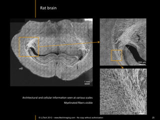 Adipocytes	
  
  200	
  µm	
  




                  9um	
  depth	
                              27um	
  depth	
     60um	
  depth	
  



Reconstructed	
  
depth	
  slice	
  
                              50	
  µm	
  

                  © LLTECH 2011                                                                       25
 