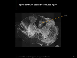 Cross	
  secIon	
  of	
  rat	
  lung	
  




                Scale	
  bar	
  =J	
  	
  0.5	
  mm	
  nform	
  2011,	
  	
  2:28.	
  	
  
                Jain	
  et	
  al.	
   Pathol	
  I
© LLTECH 2011                                                                                32
 