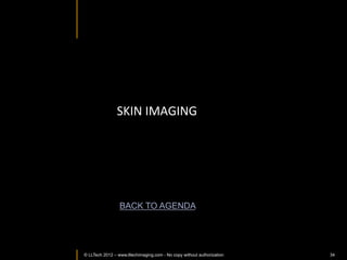 Adenocarcinoma	
  of	
  lung	
  with	
  lepidic	
  &	
  invasive	
  components	
  	
  




                                                     Invasive	
  	
                                                                         Invasive	
  	
  




                                                                                                     Lepidic	
  	
  


Lepidic	
  	
  

                                                                        Invasive	
  	
                                                                           Invasive	
  	
  




        © LLTECH 2011 FOCT	
  ~	
  4	
  mm	
  x	
  4	
  mm;	
  H&E	
  =	
  4X	
  .	
  Insets:	
  FFOCT	
  ~	
  0.375mm	
  x	
  0.375mm;	
  H&E	
  =	
  20X	
  
              FOV:	
  F                                                                                                                                                     34
 