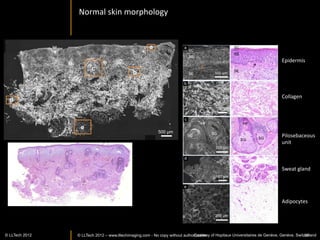 KIDNEY	
  




© LLTECH 2011                35
 