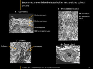 H&E	
  image	
  from	
  non-­‐neoplasIc	
  kidney	
  
Glomerulus	
                                                             Blood	
  vessel	
  




                                                                                               Glomerulus	
  20X	
  


                       Tubules	
  




                                                                                                 Tubules	
  20X	
  




                           H&E	
  =	
  10X	
  


                        Caron	
  et	
  al.	
  Proc	
  SPIE	
  2013	
  
     © LLTECH 2011                                                                               Blood	
  vessel	
  20X	
     37
 