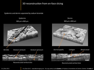 ReIna	
  




                                                        Photoreceptors - pig




       Nerve	
  ﬁber	
  layer	
  -­‐	
  rat	
                                                                                 OpIc	
  Nerve	
  -­‐	
  pig	
  




                                                                                               Retinal pigment epithelium - pig
                                                                     ReIna	
  -­‐	
  rat	
  

                                                   Grieve et al IOVS 2004 Nov;45(11):4126-31.
©	
  LLTech	
  2012	
   © LLTECH 2011                                                                                             Courtesy	
  of	
  ESPCI,	
  Paris,	
  France	
  
                                                                                                                                                                           40
 