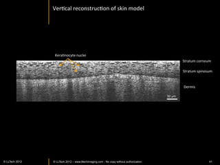 Human	
  graa	
  cornea:	
  over	
  500um	
  thickness	
  




                                                                                                        50	
  um	
  
                                            Ghouali	
  et	
  al,	
  ARVO	
  2013	
  
www.lltechimaging.com
          © LLTECH 2011                                                                Courtesy of Vincent Borderie
                                                                                                               41
 