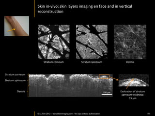 Developmental	
  biology:	
  Drosophila	
  




                                                                       200 µm




© LLTech 2012 © LLTECH 2011                                                     Courtesy of ESPCI, Paris, France
                                                                                                             49
 