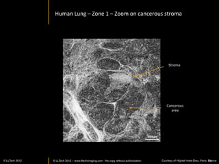 Musée d’Histoire Naturelle
                                    Xenopus	
  Laevis	
  




                                                                                CarIlage	
  
Pigmented	
  cells	
  




                                                                                          OIc	
  vesicle	
  




                    100	
  um	
  




           © LLTECH 2011                                                                              52
 