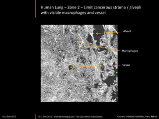 Musée d’Histoire Naturelle
                                Xenopus	
  Laevis	
  

 50	
  um	
  




Reconstructed depth slices




                © LLTECH 2011                                                        53
 