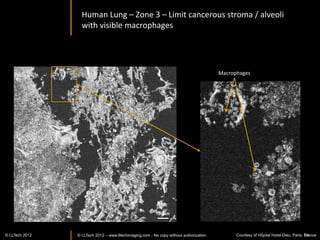 Xenopus	
  Laevis	
  eye:	
  en	
  face	
  slices	
                                 Musée d’Histoire Naturelle




Surface	
                      10um	
  depth	
         20um	
  depth	
      30um	
  depth	
  




40um	
  depth	
                50um	
  depth	
         60um	
  depth	
       70um	
  depth	
  




80um	
  depth	
               140um	
  depth	
                               230um	
  depth	
  
                                                       180um	
  depth	
                                  200	
  um	
  
              © LLTECH 2011                                                                                  54
 