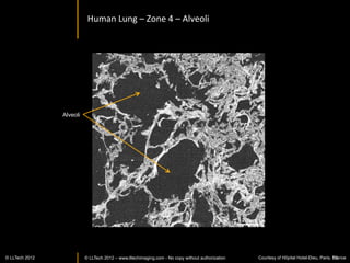 C.	
  elegans	
  –	
  Images	
  at	
  higher	
  magniﬁcaIon:	
  40X	
  




                                                                            100 µm




                                                                             3D	
  reconstrucIon	
                          50 µm

© LLTech 2012 © LLTECH 2011                                                                             Courtesy of ENS, Paris, France
                                                                                                                                   55
 