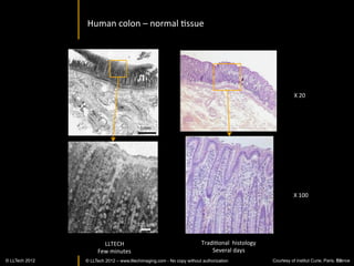 Leaf	
  veins	
  –	
  fresh	
  leaf	
  sample	
  




                                                                                  Veins	
  




                                                                 500 µm




                                                                   Fibers	
  

                                                                                                                     100 µm




                                                                                              57
© LLTech 2012 © LLTECH 2011                                                                        Courtesy of ESPCI, Paris, France
                                                                                                                                57
 