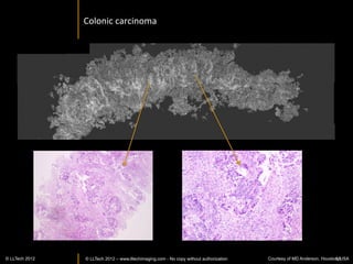 Apple	
  



                                                   Wax	
  

                                                   Skin	
  




                                                       Water	
  




                                                   Flesh	
  




                                          500 µm                                          100 µm




                                                                   58
© LLTech 2012 © LLTECH 2011                                             Courtesy of ESPCI, Paris, France
                                                                                                     58
 