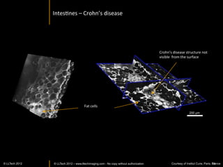 Sorghum:	
  cross	
  secIon	
  




       Courtesy of Plate-forme
 d'Histocytologie et d'Imagerie
                                  Wide	
  ﬁeld	
  en	
  face	
  
    Cellulaire Végétale (PHIV)
      Montpellier RIO2011
          © LLTECH Imaging
                                  14mmX15mm	
   59
 