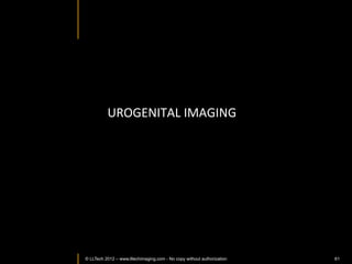 Courtesy of Plate-forme
                                                                                d'Histocytologie et d'Imagerie
                                                                                   Cellulaire Végétale (PHIV)

                             Rice:	
  hypocotyle	
                                   Montpellier RIO Imaging




                                                                      Wide	
  ﬁeld	
  en	
  face	
  
                                                                      5mmX2mm	
  
                                                                      	
  




Reconstructed	
  depth	
  slice,	
  200um	
  pentraIon	
  depth	
  




         © LLTECH 2011                                                                                    61
 