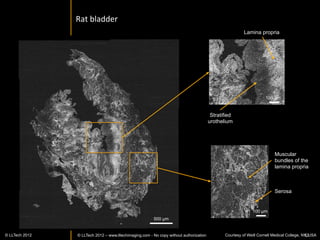 Conclusion	
  


     •      Full-­‐ﬁeld	
  OCT	
  does	
  not	
  require	
  Issue	
  preparaIon,	
  nor	
  staining	
  of	
  any	
  kind	
  
     •      Creates	
  images	
  within	
  minutes	
  using	
  a	
  non-­‐destrucIve	
  process	
  
     •      Oﬀers	
  a	
  1	
  µm	
  cellular	
  resoluIon	
  in	
  3D	
  
     •      Reveals	
  structural	
  and	
  cellular	
  informaIon	
  of	
  normal	
  and	
  pathological	
  Issue	
  
     •      Mosaicing	
  allows	
  fast	
  visualisaIon	
  at	
  various	
  scales	
  
     •      En-­‐face	
  high-­‐resoluIon	
  imaging	
  allows	
  verIcal	
  and	
  3D	
  reconstrucIon	
  
     •      Possible	
  applicaIons	
  for	
  biobanking,	
  cancer	
  detecIon,	
  digital	
  pathology…	
  
     	
  




www.lltechimaging.com
          © LLTECH 2011                                                                                                        62
 