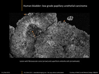 LLTech	
  


      LLTech,	
  Inc.	
                               LLTech	
  
      103	
  Carnegie	
  Center	
  Drive	
            Pépinière	
  Paris	
  Santé	
  Cochin	
  
      Suite	
  300	
                                  29	
  rue	
  du	
  Faubourg	
  Saint	
  Jacques	
  
      Princeton,	
  NJ	
  08540,	
  USA	
             75014	
  Paris	
  
      	
                                              	
  	
  
      Phone:	
  +1	
  609	
  995	
  3506	
            Phone:	
  +33	
  1	
  82	
  72	
  61	
  25	
  

                                     www.lltechimaging.com	
  
                                     	
  
                                     contact@lltech.fr	
  




www.lltechimaging.com	
  
          © LLTECH 2011                                                                                     63
 