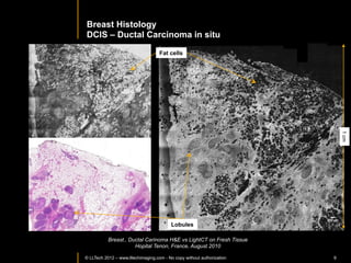PATHOLOGY	
  APPLICATIONS	
  
                	
  
                INTRAOPERATIVE	
  DIAGNOSIS	
  




© LLTECH 2011                                     9
 