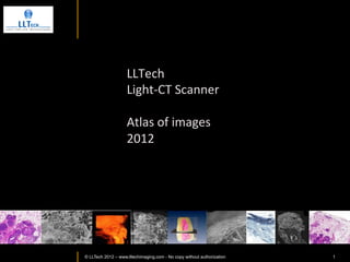 Atlas	
  of	
  images	
  
                          	
  
                          February	
  2013	
  




www.lltechimaging.com
          © LLTECH 2011                               1
 
