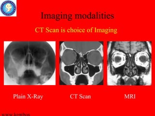 Mri Scan Sinus Machine Imaging for Endoscopic Sinus Surgery | PPS