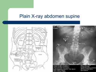 University of
Alexandria
Plain X-ray abdomen supine
 