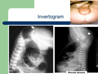 University of
Alexandria
Invertogram
 