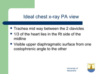 University of
Alexandria
Ideal chest x-ray PA view
 Trachea mid way between the 2 clavicles
 1/3 of the heart lies in the Rt side of the
midline
 Visible upper diaphragmatic surface from one
costophrenic angle to the other
 