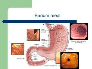 University of
Alexandria
Barium meal
 