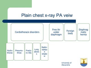 University of
Alexandria
Plain chest x-ray PA veiw
 
