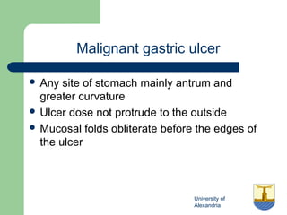 University of
Alexandria
Malignant gastric ulcer
 Any site of stomach mainly antrum and
greater curvature
 Ulcer dose not protrude to the outside
 Mucosal folds obliterate before the edges of
the ulcer
 
