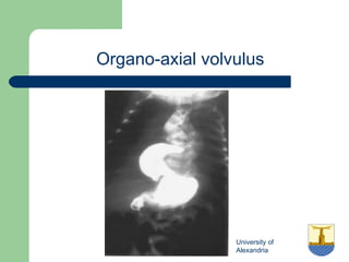 University of
Alexandria
Organo-axial volvulus
 